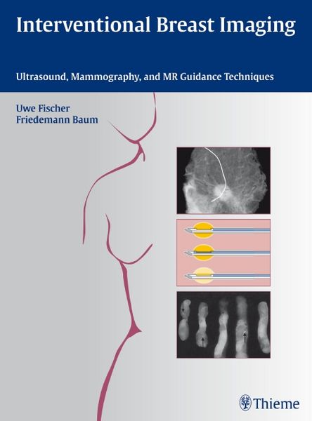 Produktbild: Interventional Breast Imaging