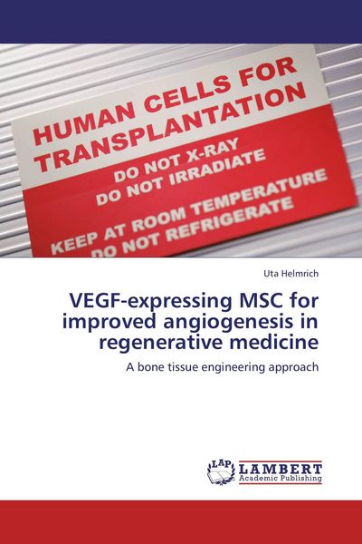 Produktbild: VEGF-expressing MSC for improved angiogenesis in regenerative medicine