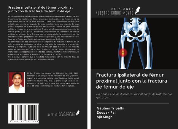 Produktbild: Fractura ipsilateral de f&eacute;mur proximal junto con la fractura de f&eacute;mur de eje