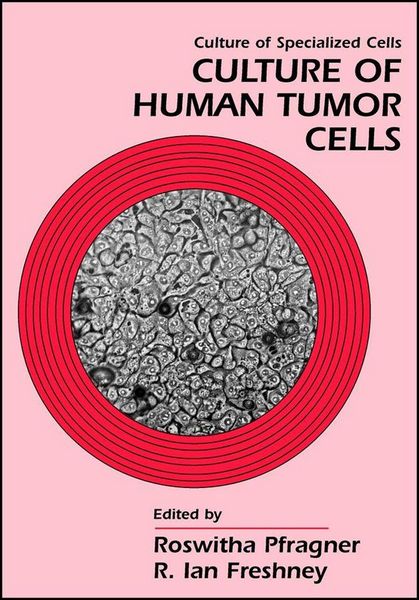 Produktbild: Culture of Human Tumor Cells