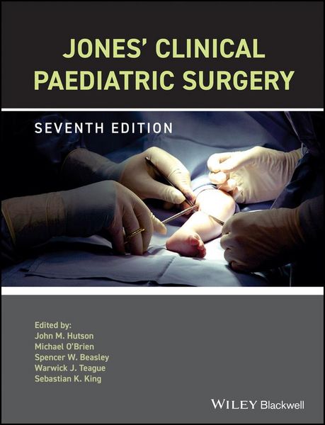 Produktbild: Jones' Clinical Paediatric Surgery