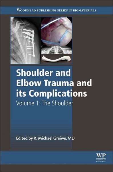 Produktbild: Shoulder and Elbow Trauma and Its Complications