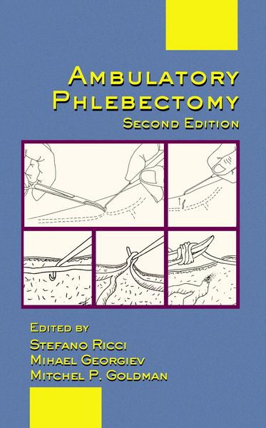 Produktbild: Ambulatory Phlebectomy