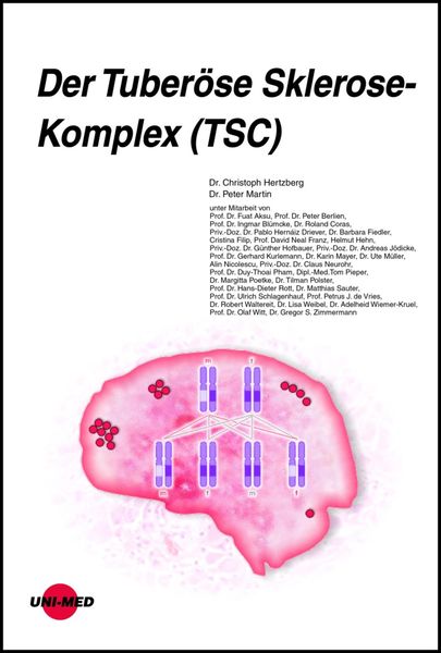 Produktbild: Der Tuber&ouml;se Sklerose-Komplex (TSC)