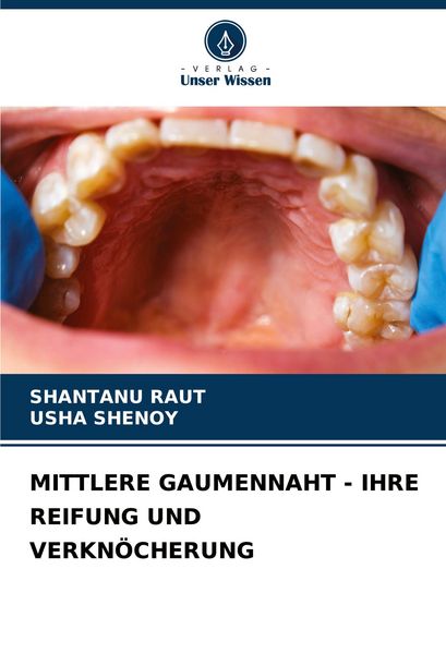 Mittlere Gaumennaht - Ihre Reifung und Verknöcherung, Taschenbuch von Shantanu Raut , Usha Shenoy, Verlag Unser Wissen, 9786202334525