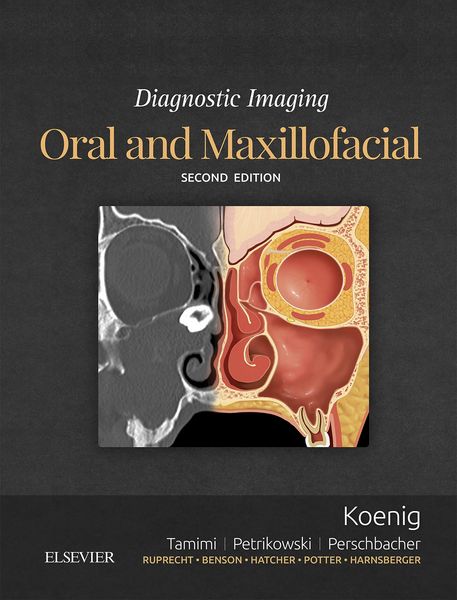 Produktbild: Diagnostic Imaging: Oral and Maxillofacial E-Book