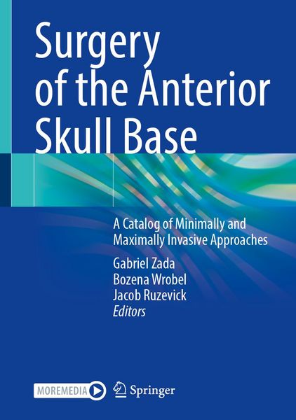 Produktbild: Surgery of the Anterior Skull Base