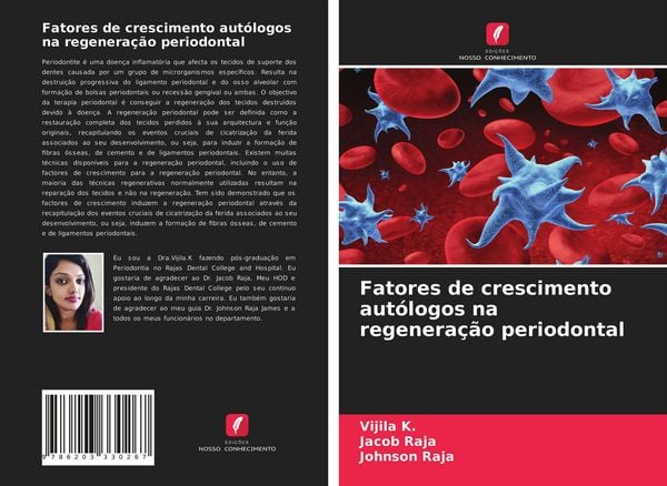 Produktbild: Fatores de crescimento aut&oacute;logos na regenera&ccedil;&atilde;o periodontal