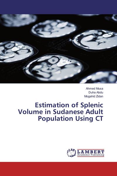 Produktbild: Estimation of Splenic Volume in Sudanese Adult Population Using CT