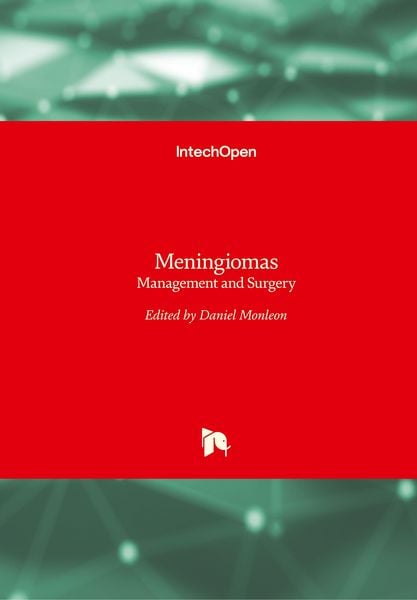 Produktbild: Meningiomas