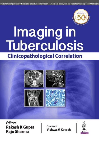 Produktbild: Imaging in Tuberculosis