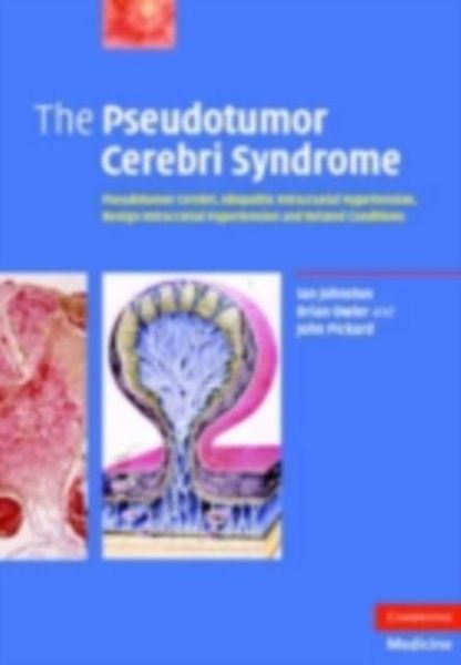 Produktbild: Pseudotumor Cerebri Syndrome