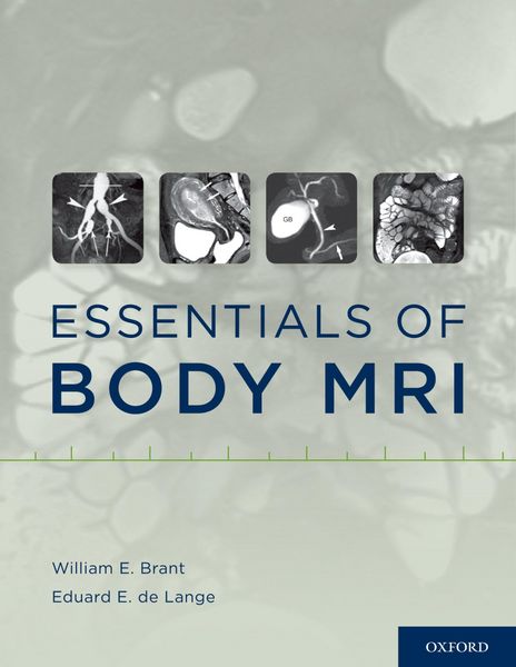 Produktbild: Essentials of Body MRI