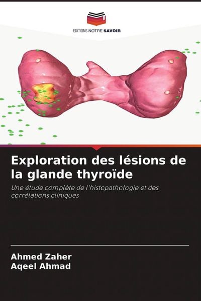 Produktbild: Exploration des l&eacute;sions de la glande thyro&iuml;de