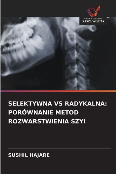 Produktbild: Selektywna Vs Radykalna: Por&oacute;wnanie Metod Rozwarstwienia Szyi
