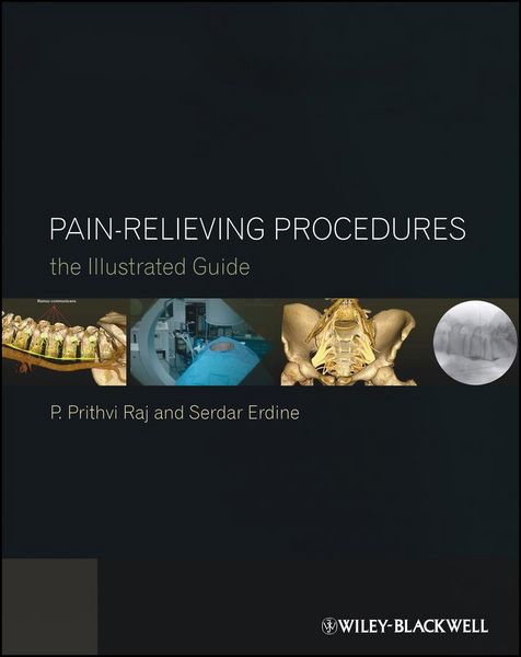 Produktbild: Pain-Relieving Procedures