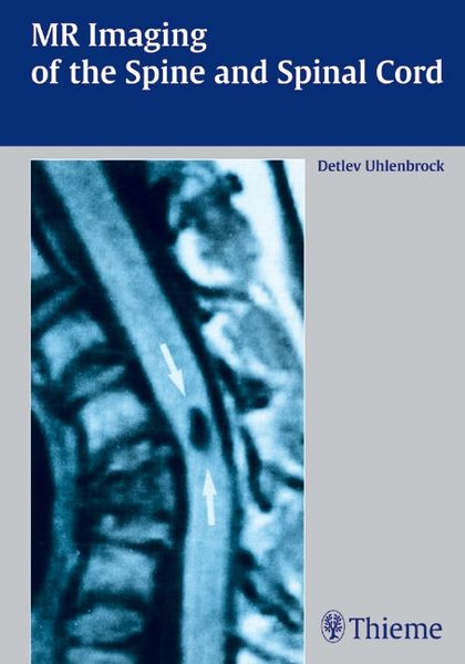 Produktbild: MR Imaging of the Spine and Spinal Cord