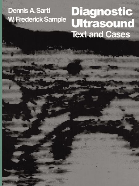 Produktbild: Diagnostic Ultrasound