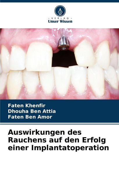 Auswirkungen des Rauchens auf den Erfolg einer Implantatoperation, Taschenbuch von Faten Khenfir , Dhouha Ben Attia , Faten Ben Amor, Verlag Unser