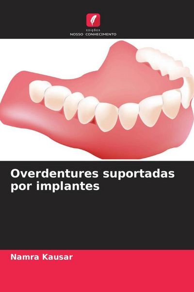 Produktbild: Overdentures suportadas por implantes