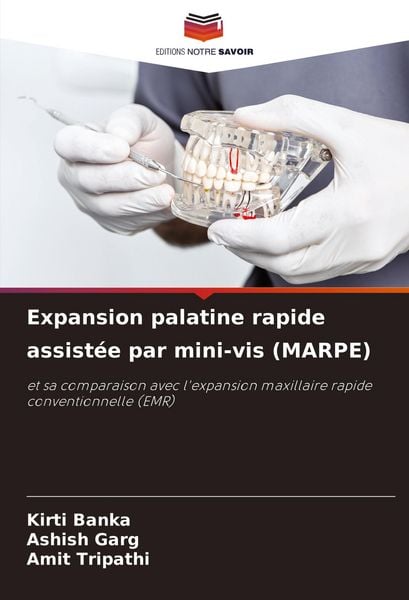 Produktbild: Expansion palatine rapide assist&eacute;e par mini-vis (MARPE)