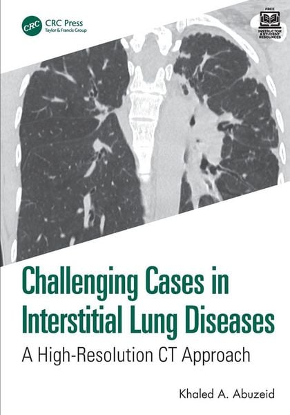 Produktbild: Challenging Cases in Interstitial Lung Diseases