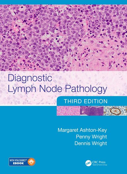 Produktbild: Diagnostic Lymph Node Pathology