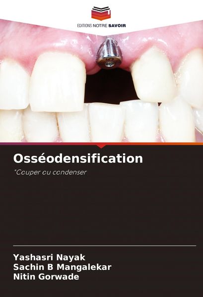 Produktbild: Oss&eacute;odensification