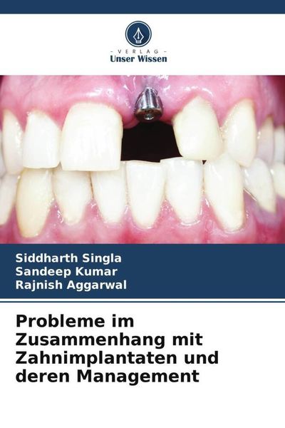 Produktbild: Probleme im Zusammenhang mit Zahnimplantaten und deren Management