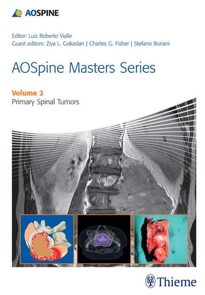 Produktbild: AOSpine Masters Series, Volume 2: Primary Spinal Tumors
