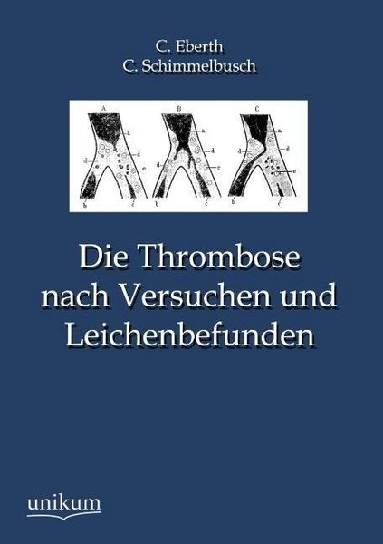 Produktbild: Eberth, C: Thrombose nach Versuchen und Leichenbefunden