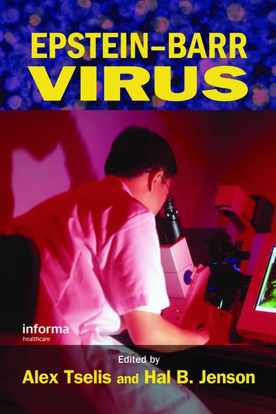 Produktbild: Epstein-Barr Virus