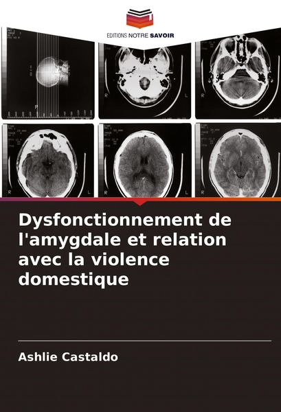 Produktbild: Dysfonctionnement de l'amygdale et relation avec la violence domestique