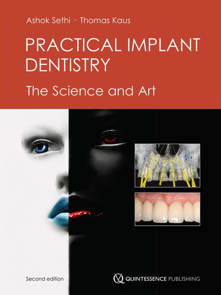 Produktbild: Practical Implant Dentistry