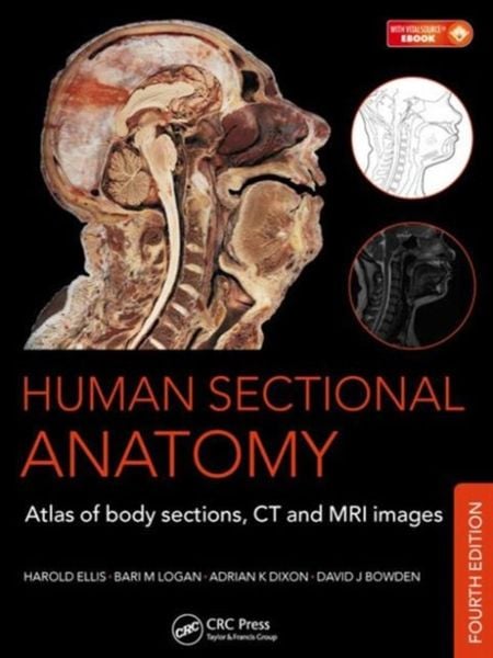 Produktbild: Human Sectional Anatomy