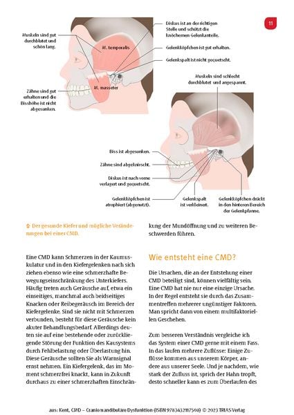 Produktbild: CMD - Craniomandibul&auml;re Dysfunktion