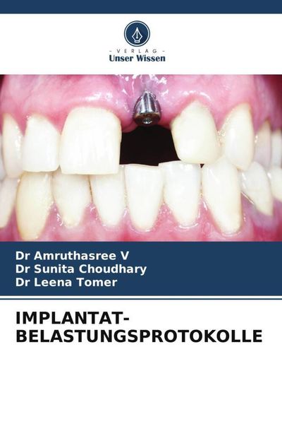 Produktbild: Implantat-Belastungsprotokolle
