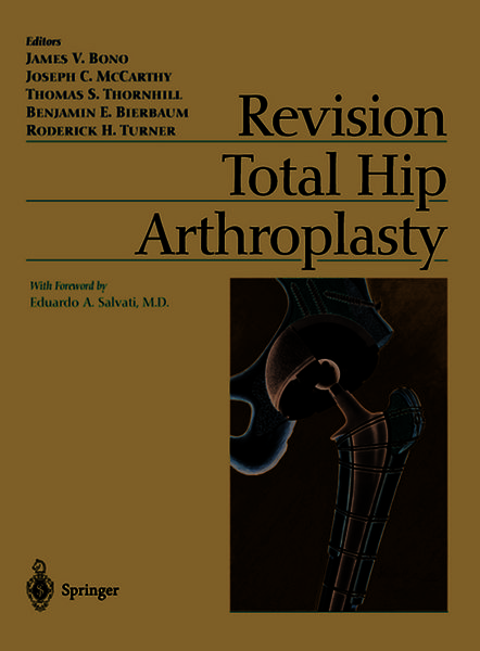 Produktbild: Revision Total Hip Arthroplasty