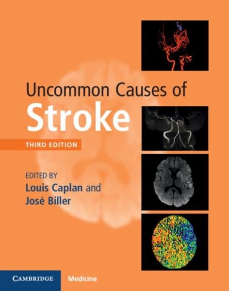 Produktbild: Uncommon Causes of Stroke