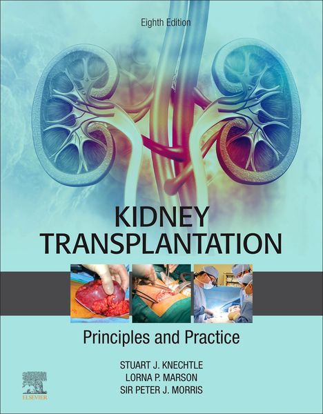 Produktbild: Kidney Transplantation - Principles and Practice E-Book