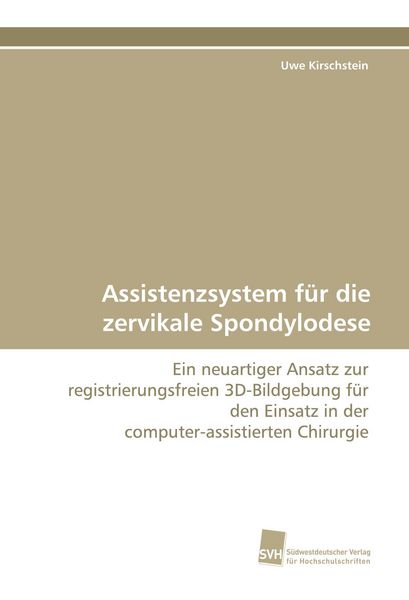 Produktbild: Assistenzsystem f&uuml;r die zervikale Spondylodese