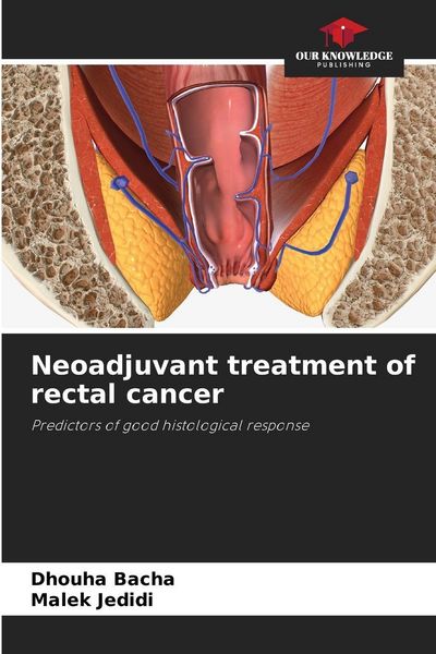 Produktbild: Neoadjuvant treatment of rectal cancer