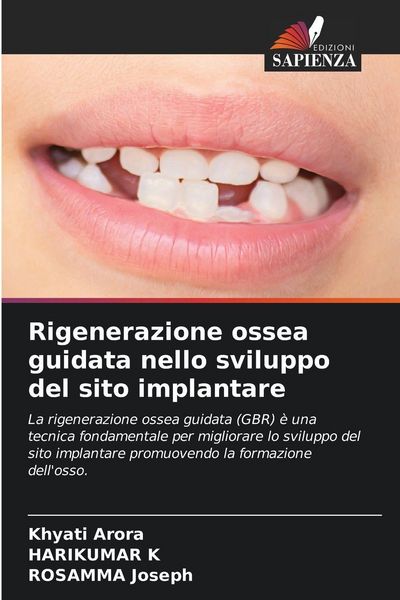 Produktbild: Rigenerazione ossea guidata nello sviluppo del sito implantare