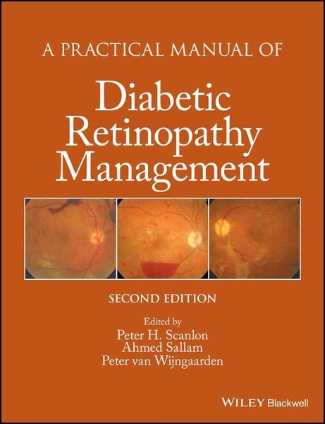 Produktbild: A Practical Manual of Diabetic Retinopathy Management