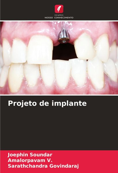 Produktbild: Projeto de implante