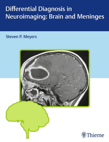 Produktbild: Differential Diagnosis in Neuroimaging: Brain and Meninges