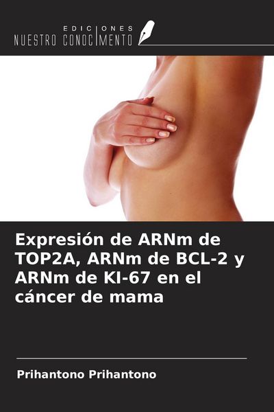 Produktbild: Expresi&oacute;n de ARNm de TOP2A, ARNm de BCL-2 y ARNm de KI-67 en el c&aacute;ncer de mama