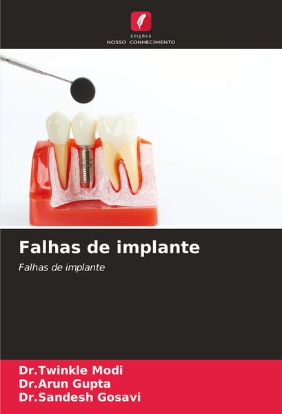 Produktbild: Falhas de implante