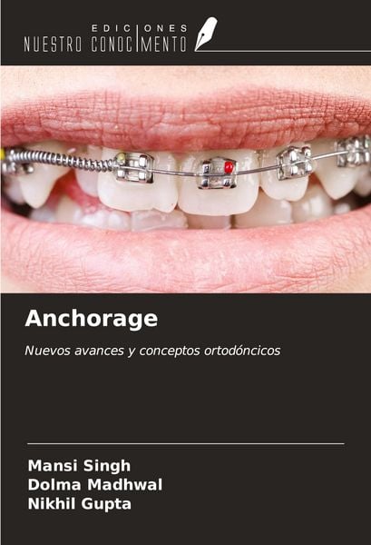 Produktbild: Anchorage