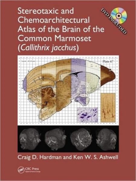 Produktbild: Hardman, C: Stereotaxic and Chemoarchitectural Atlas of the